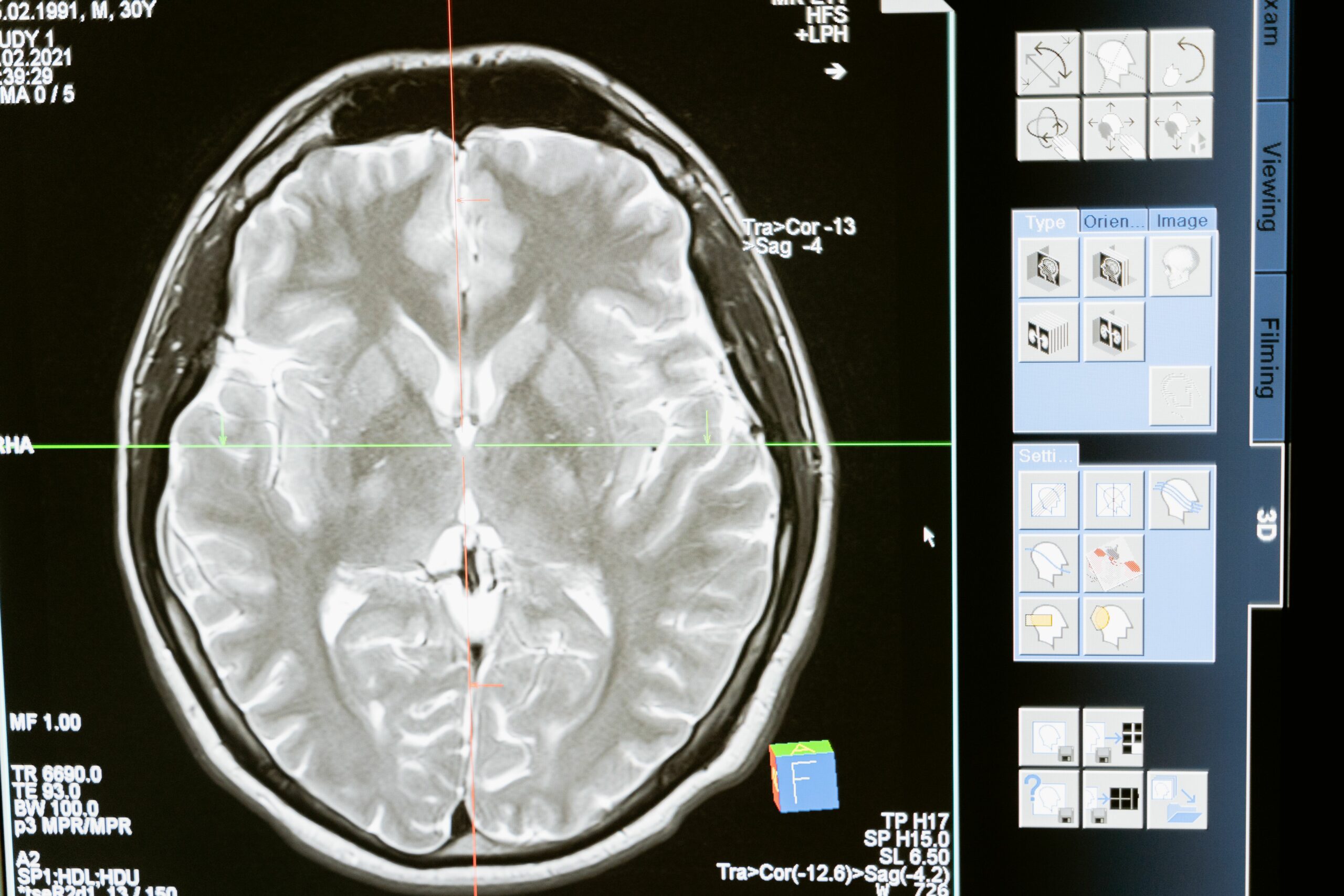 Brain scan showing neuroscience research related to gambling addiction